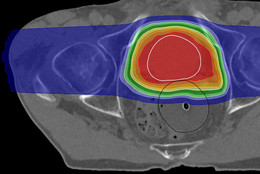 Medizinphysik Headerbild Medizinphysik